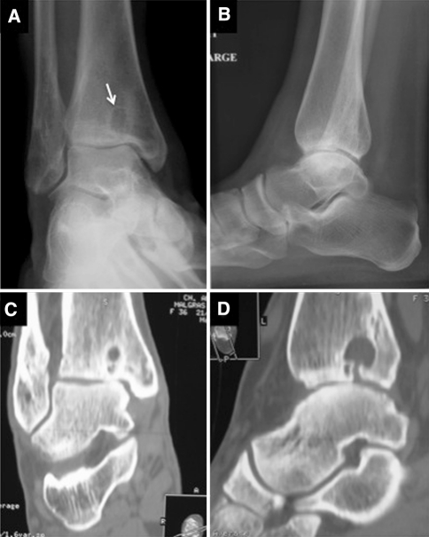 Fig. 3A–D