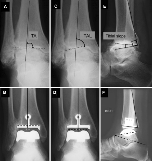 Fig. 1A–F