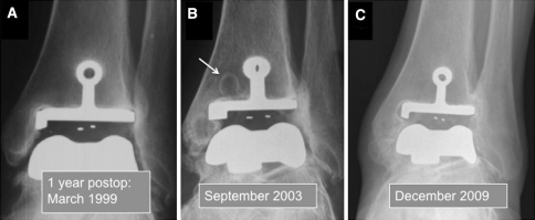 Fig. 7A–C