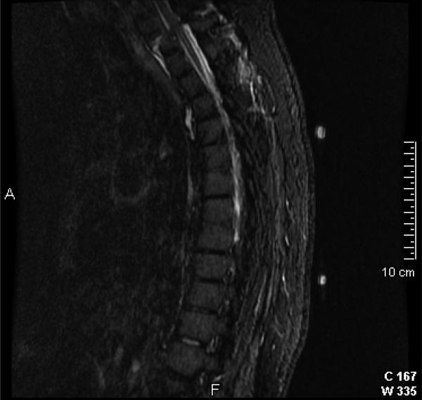 Figure 2a