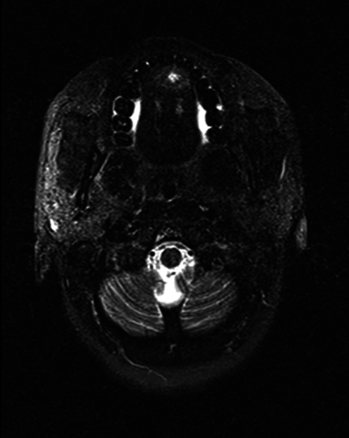 Fig. 5