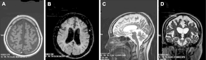 Fig. 2