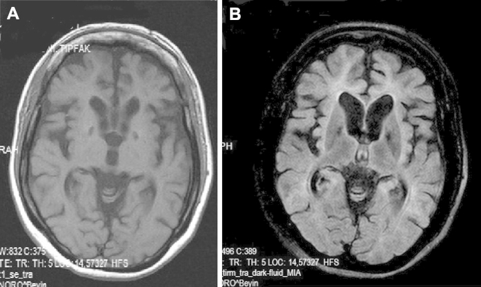 Fig. 3