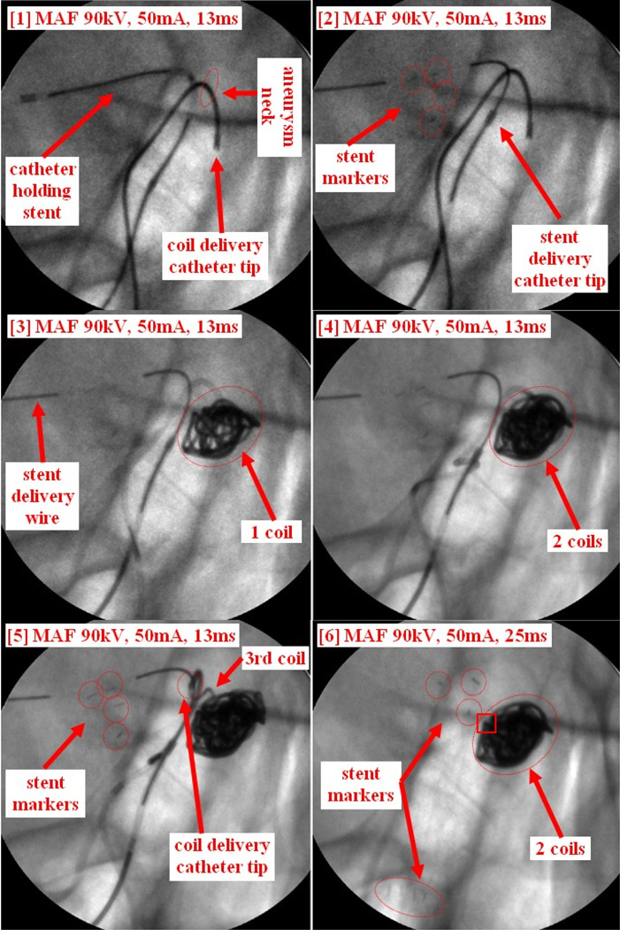 Figure 13