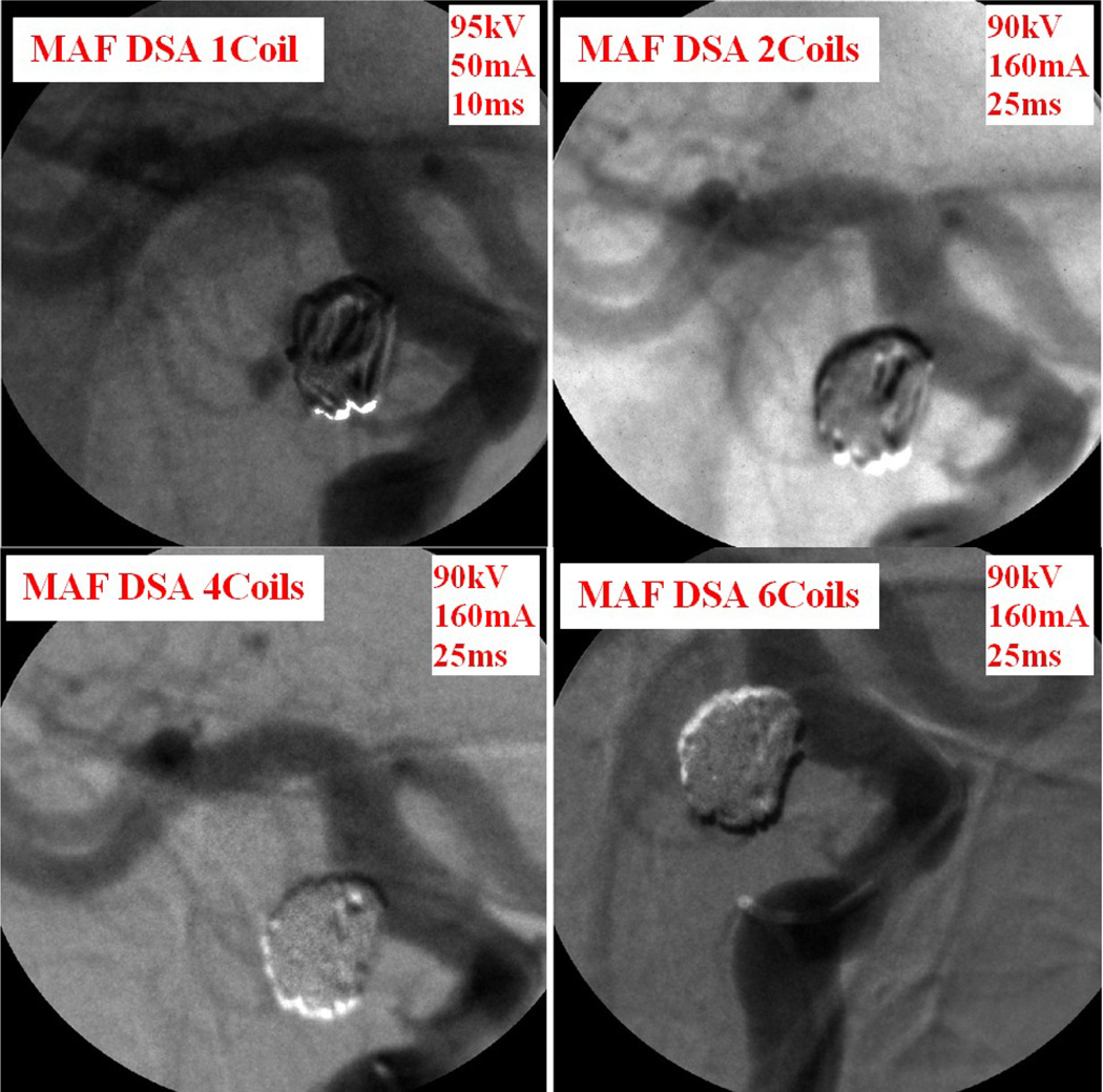 Figure 12