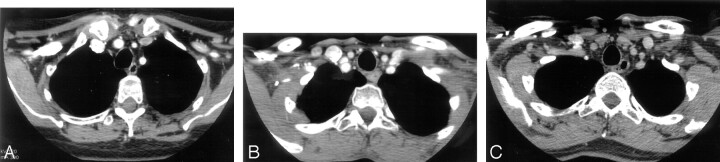 Fig 3.
