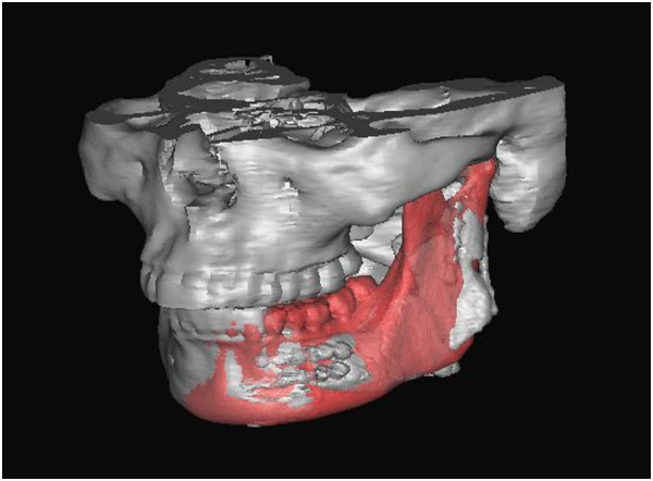 Figure 19