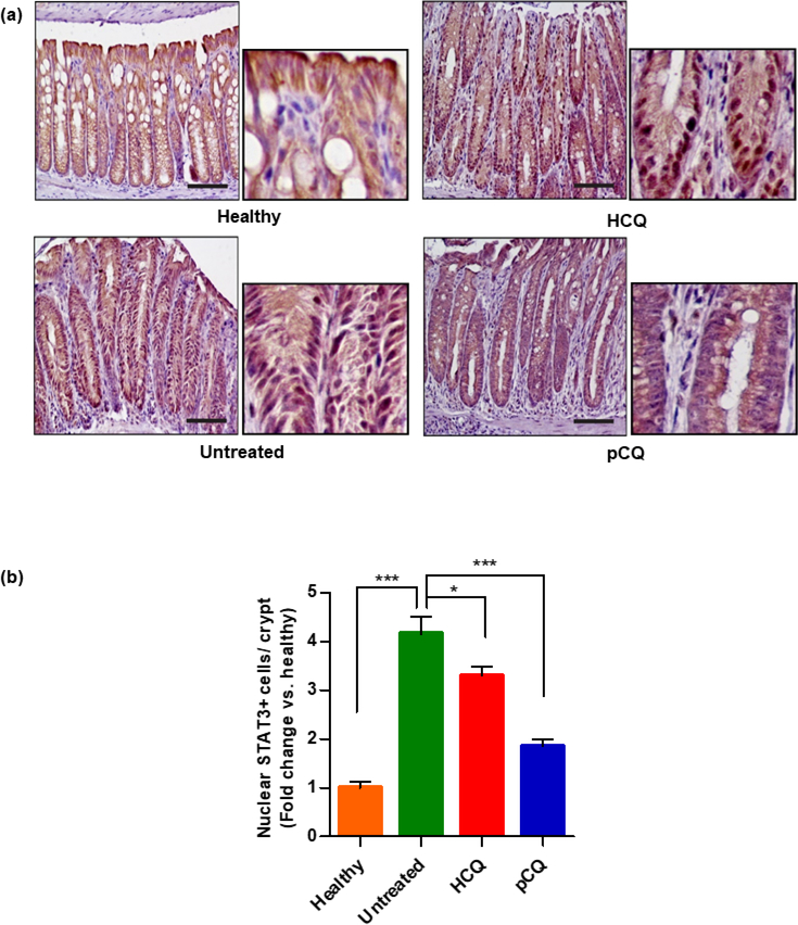 Figure 11.