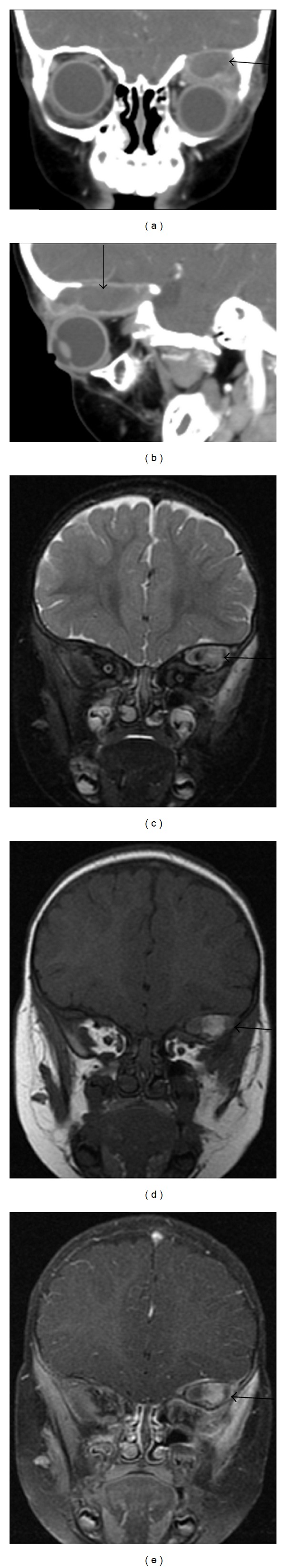 Figure 13