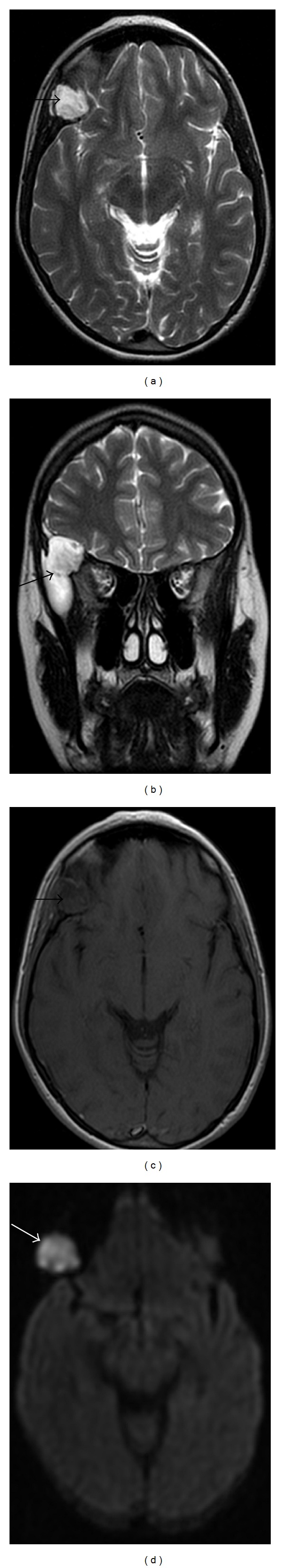 Figure 12