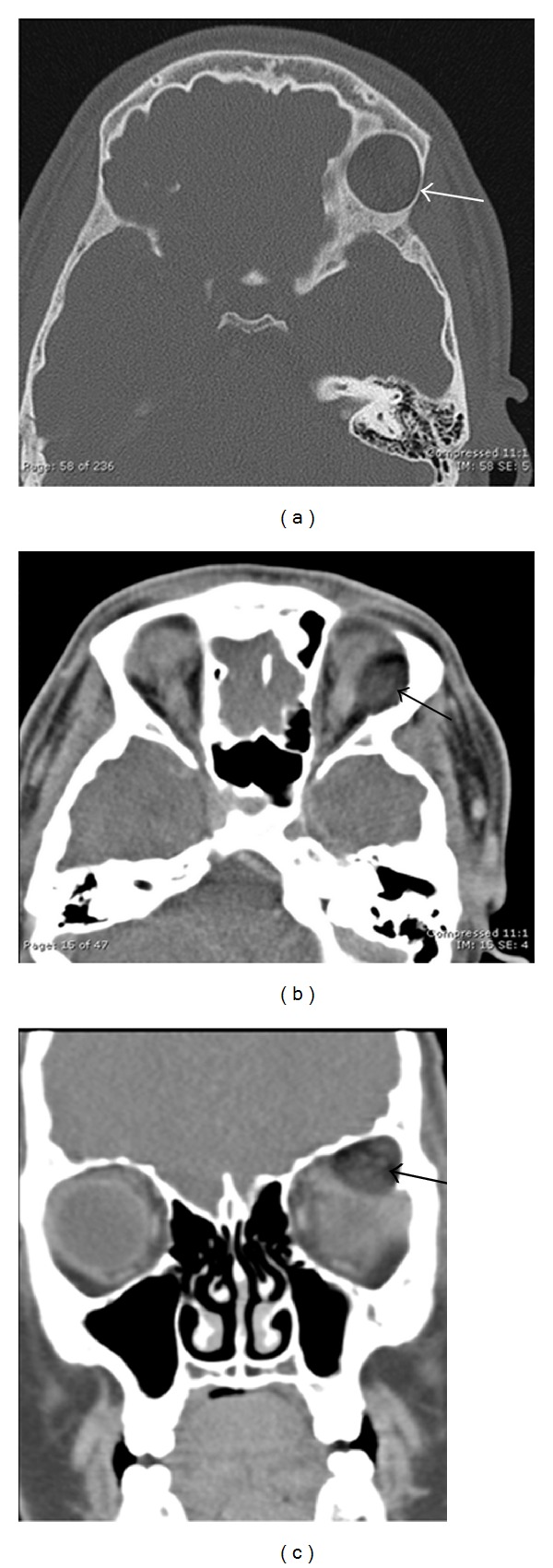 Figure 11