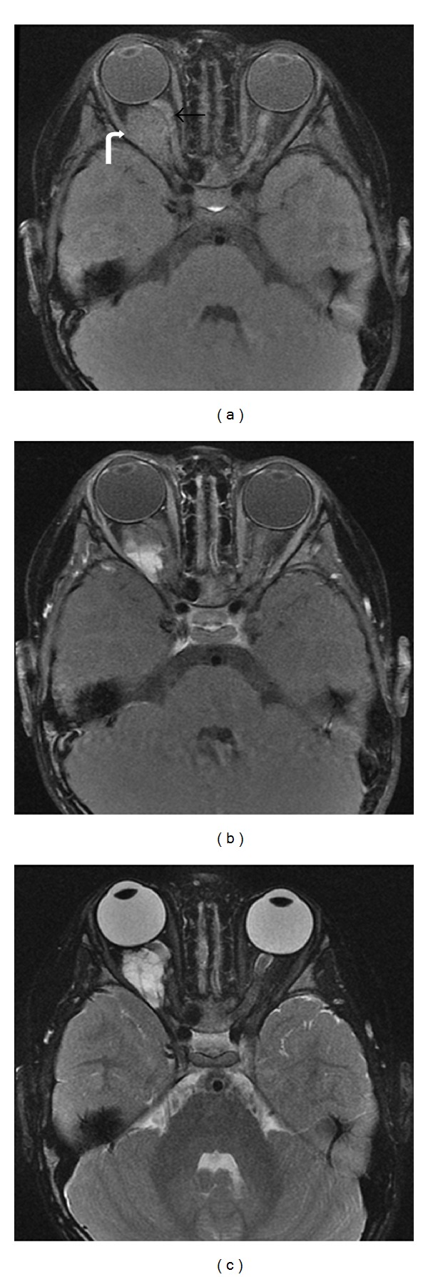 Figure 14