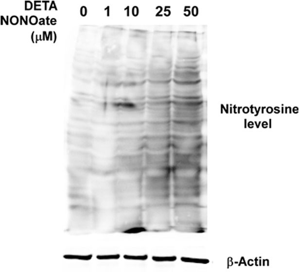 Clinical Implications of iNOS Levels in Triple-Negative Breast Cancer ...