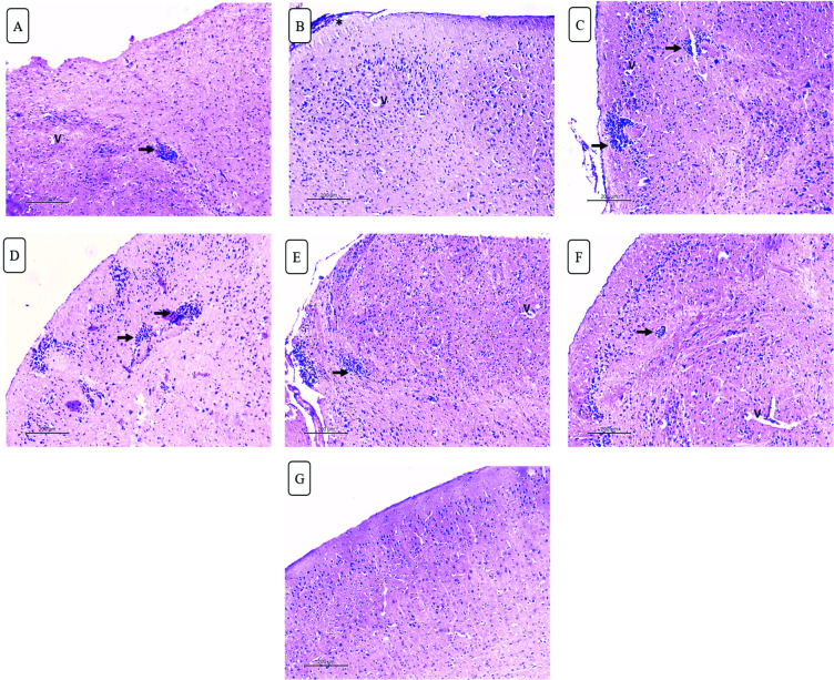 Fig 10