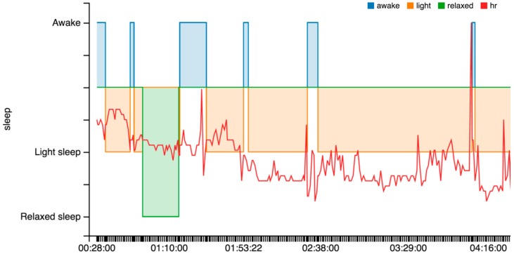 Figure 13