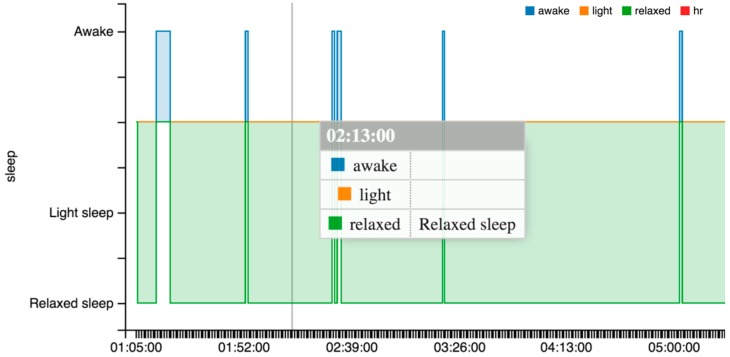 Figure 14