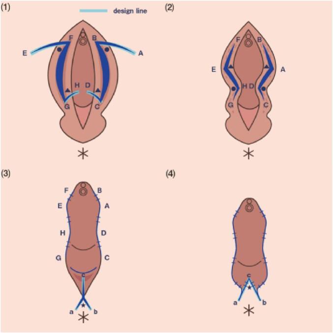 Fig. 2