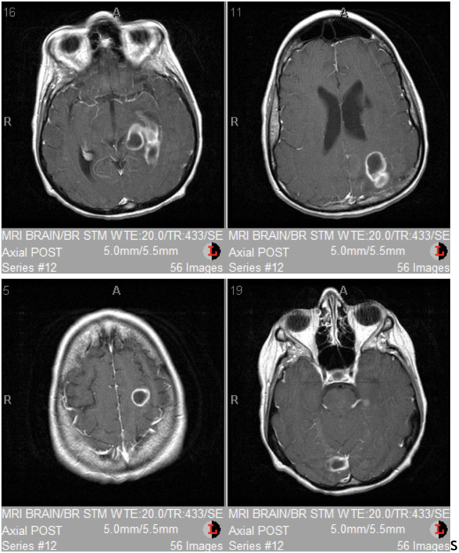 FIGURE 1