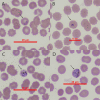 FIG 1