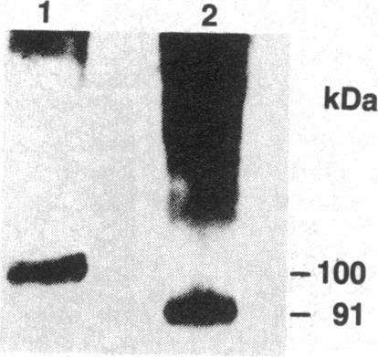 graphic file with name pnas00321-0332-a.jpg