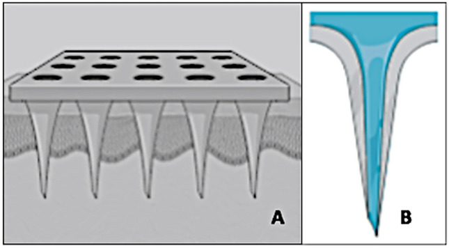 Fig. 4