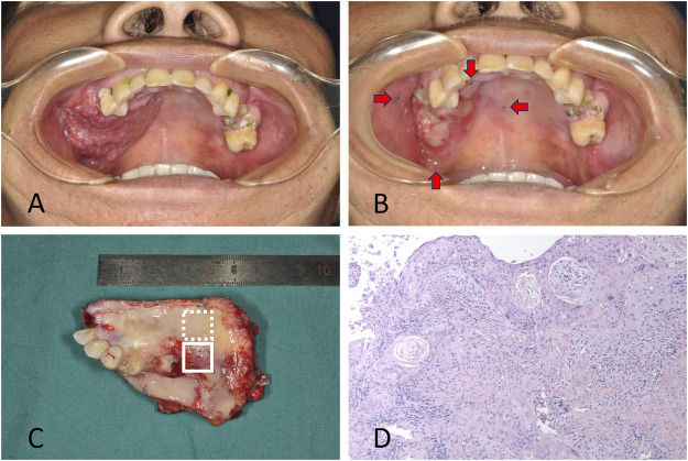 FIGURE 1