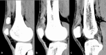 Fig.ure 2.