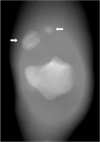 Fig.ure 1.