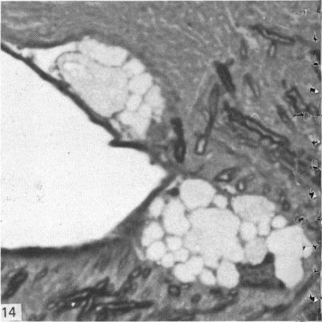 Fig. 14