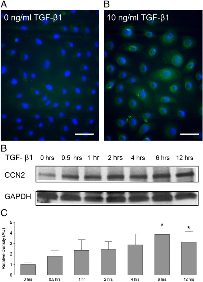 IWJ-12749-FIG-0004-c