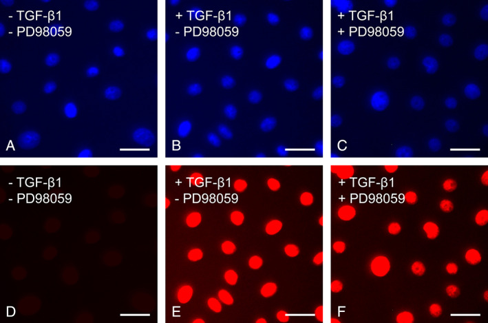 IWJ-12749-FIG-0010-c