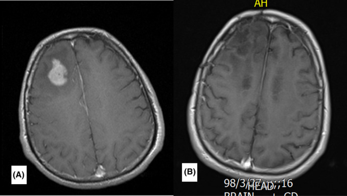 FIGURE 4