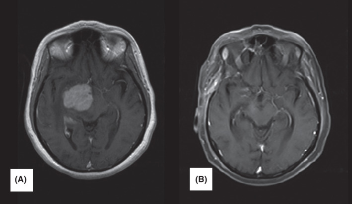 FIGURE 1