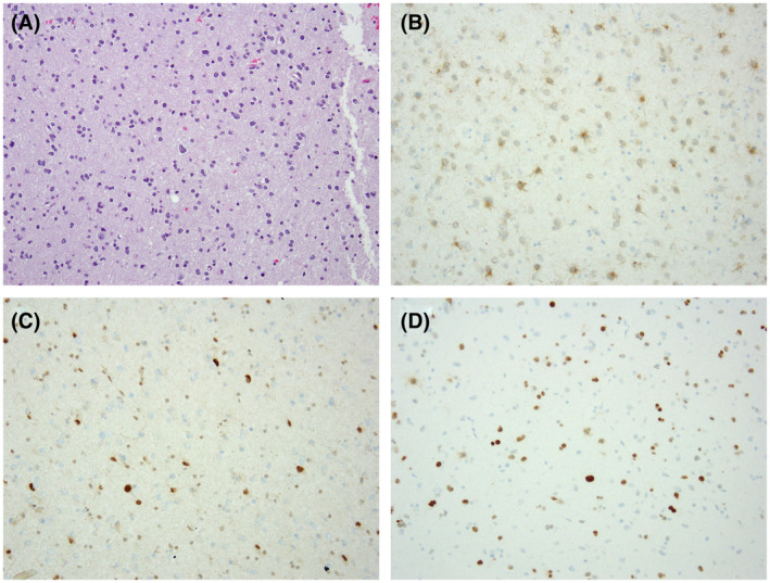 FIGURE 2