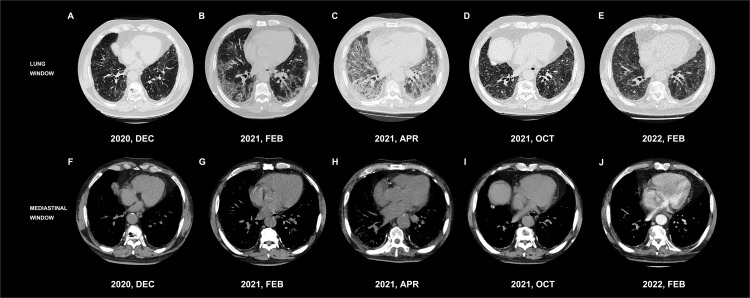 Figure 2