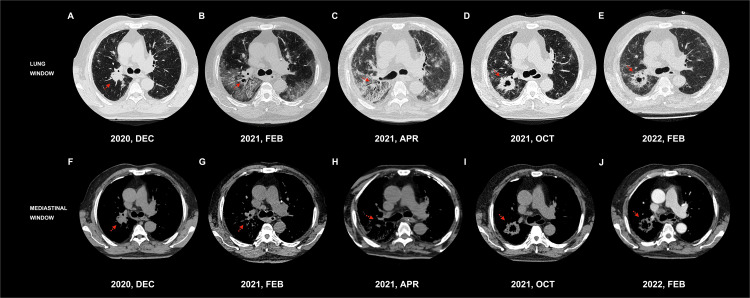 Figure 1