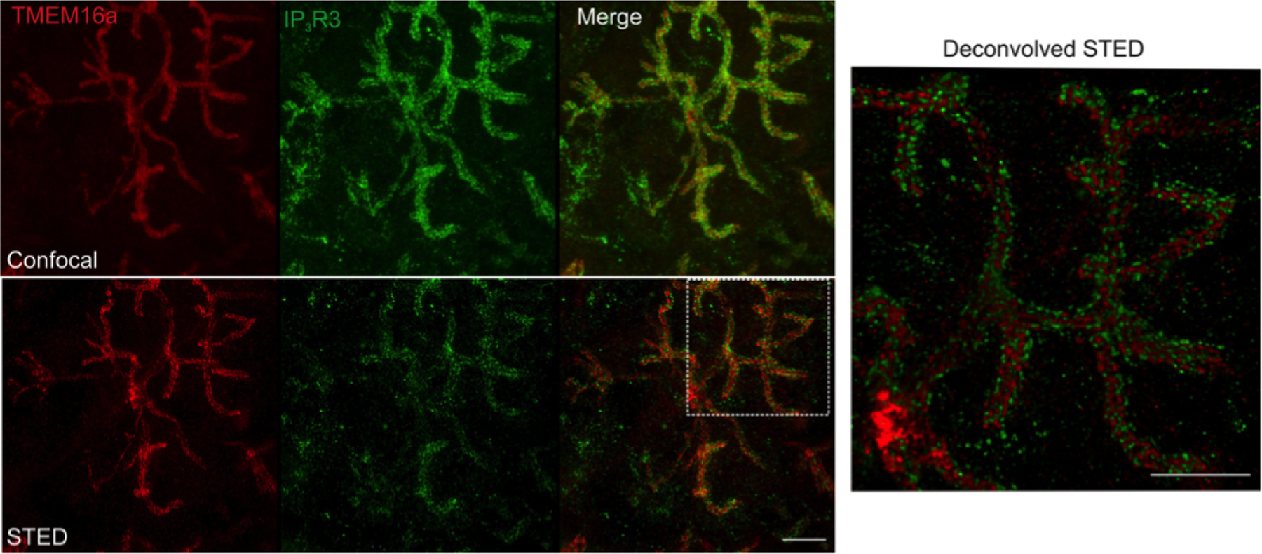 Calcium Dynamics And Water Transport In Salivary Acinar Cells - Pmc