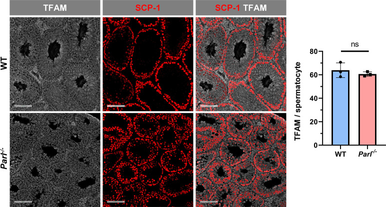 Figure 4—figure supplement 1.