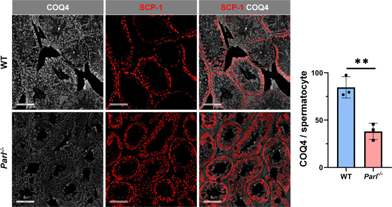 Figure 6—figure supplement 1.