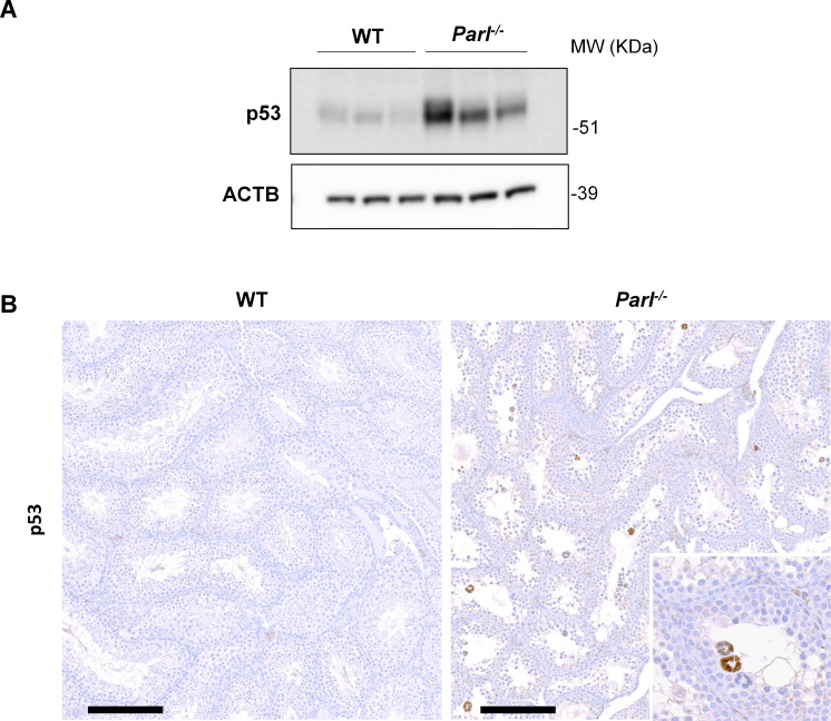 Figure 7—figure supplement 3.