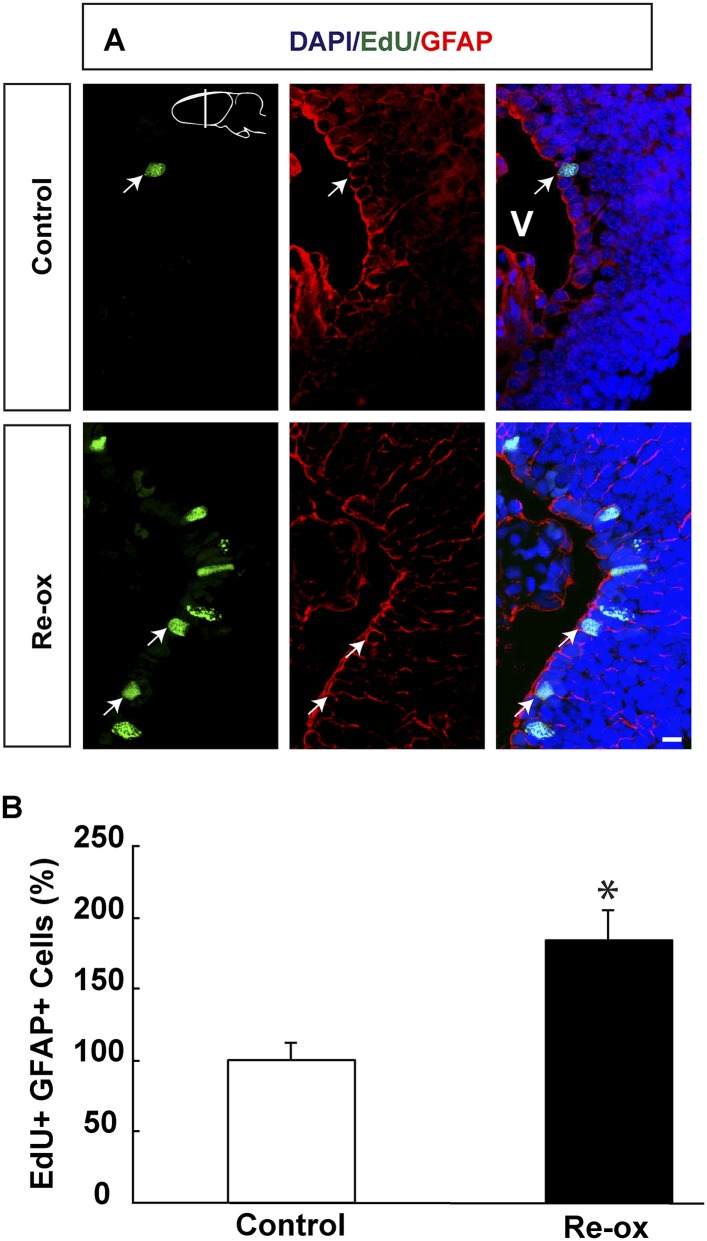 Figure 2—figure supplement 1.