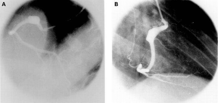 Figure 2  