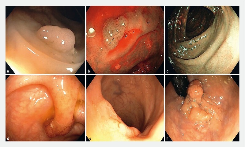 Fig. 1 