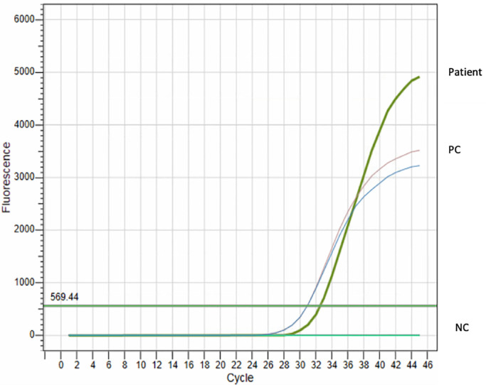 Fig 2