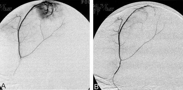 Fig 2.