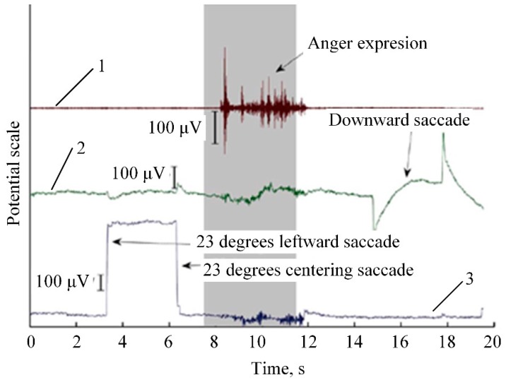 Figure 14