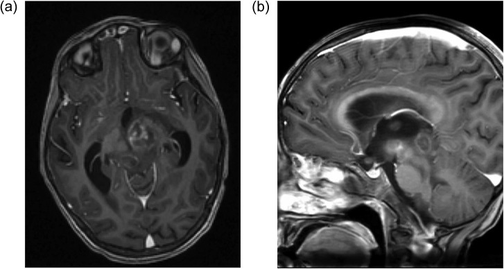 Figure 1: