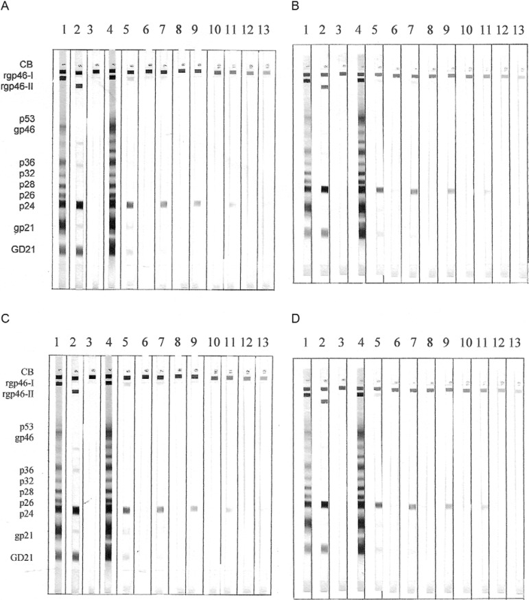 Trial repeated four times, on alternate days, in empirical dilution
of 1:2, 1:4, 1:8 and 1:16 of patient H08€(tm)s samples. Strip 1:
positive control human T-lymphotropic virus type 1 (HTLV-1); 2: positive
control HTLV-2; 3: negative control; 4, 5: serum/cerebrospinal fluid
(CSF) in nature; 6, 7: serum/CSF 1:2; 8, 9: serum/CSF 1:4; 10, 11:
serum/CSF 1:8; 12, 13: serum/CSF 1:16.