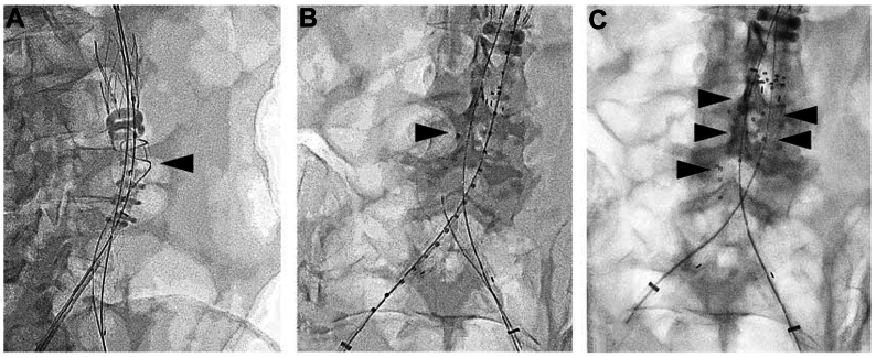 Fig 3