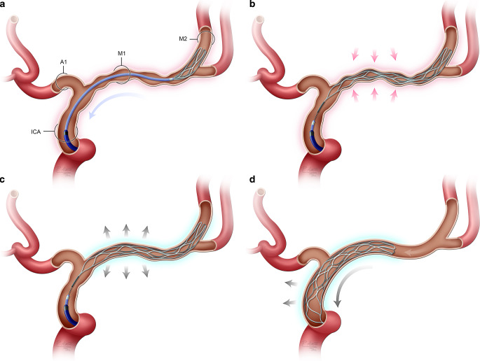 Fig. 1